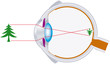 Vision, Optics, Eyeball (Sehen, Optik, Augapfel)