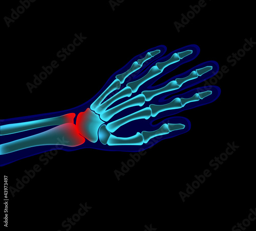 Vector: hand pain hand pain