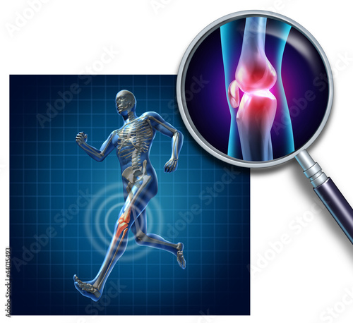 Illustration: Sports Knee Injury Sports Knee Injury