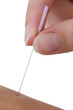 Acupuncture - Symbole
