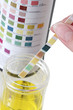 Analyse urinaire - Sel control