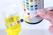 Bandelette urinaire - Diagnostic