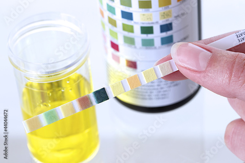 Photo: Bandelette urinaire - Diagnostic Bandelette urinaire - Diagnostic