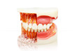 Denture isolated on white