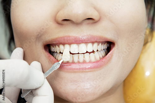 Photo: Examining teeth Examining teeth