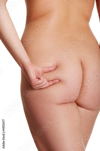 Photo: Nude woman's bottom with cellulite. Nude woman's bottom with cellulite.