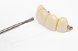 small dental drill with bridge