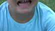 Video: Injured little boy crying Injured little boy crying