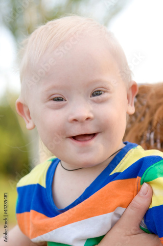 Photo: wonderful smiling baby boy with Down syndrome wonderful smiling baby boy with Down syndrome