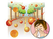 Allergia da polline