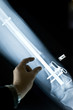X-ray