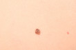 mole