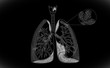 Human Lung structure