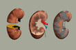 kidney, human inner organs