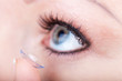 Contact lens applying, macro