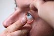 guy bringing in a contact lense