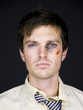 man with a black eye