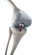 Knee artroscopy stage 2