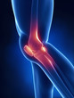 Knee x-ray blue anatomy
