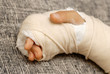 Photo: Broken arm Broken arm