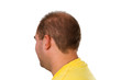 Foto: Schuetteres Haar Schuetteres Haar