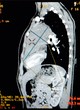 MRI scan of human heart