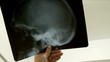 Viewing X-ray image of skull