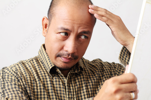 Photo: Balding Balding