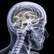 Skeleton X-Ray - Brain Off