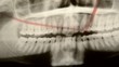 Dentista دندانساز  歯医者 Zahnarzt