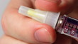 Sequence: Preparation of syringe-pen