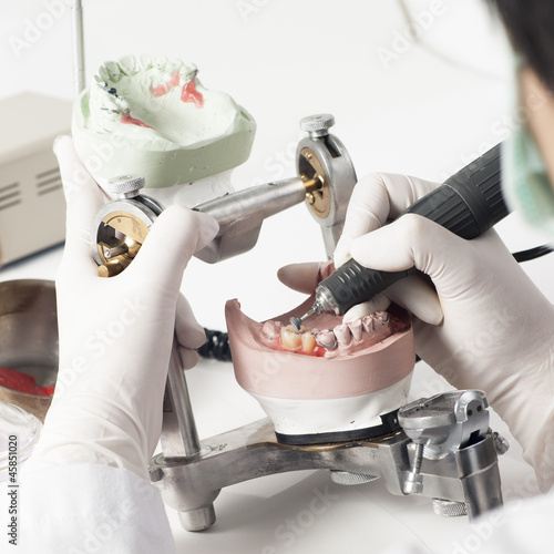 Photo: Dental technician working with articulator Dental technician working with articulator
