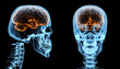 Brain inside skull