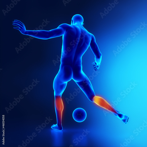 Illustration: Strained calf muscle concept in x-ray Strained calf muscle concept in x-ray