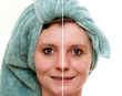 Foto: Woman with spotty skin with deep pores and blackhead Woman with spotty skin with deep pores and blackhead