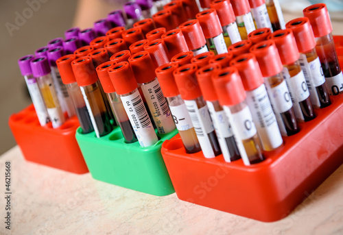 Photo: Medical test-tube with blood samples Medical test-tube with blood samples