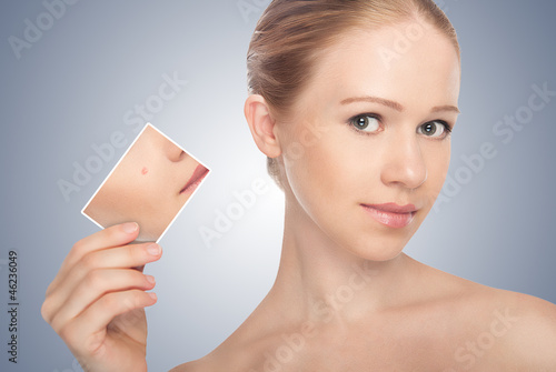 Photo: concept skincare . Skin of beauty young woman before and after t concept skincare . Skin of beauty young woman before and after t