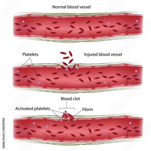 Vector: Blood clotting process, eps8 Blood clotting process, eps8