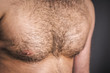 hairy chest