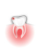 Aching tooth