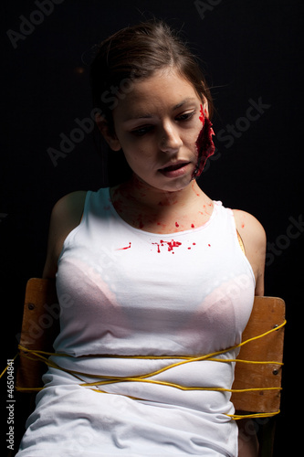 Photo: Kidnapped and tortured young woman with a big cut on her face, t Kidnapped and tortured young woman with a big cut on her face, t