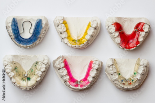 Photo: bunte Zahnspangen in Abdruckformen bunte Zahnspangen in Abdruckformen