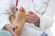 Mycoses des pieds - Symptômes