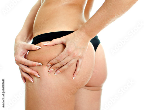 Photo: Young woman folding skin on her hips with both hands. Young woman folding skin on her hips with both hands.