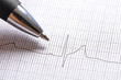 Electrocardiogram graph