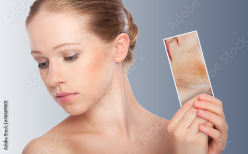 Photo: concept skincare . Skin of beauty young woman with redness, skin concept skincare . Skin of beauty young woman with redness, skin