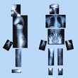 Radiography