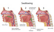 Swallowing, eps8