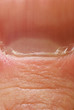 finger nail