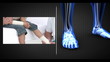 Montage of people being examined